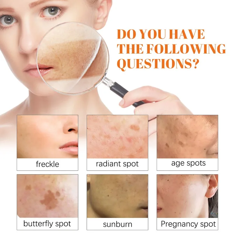 Facial Fade Spots Papaya Cream Anti-aging Brighten Skin Tone Day Cream Moisturiz Skin Improve Dark Spots Fine Lines Night Cream - Image 2