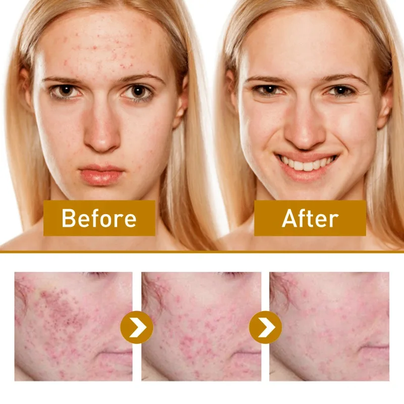 Facial Fade Spots Papaya Cream Anti-aging Brighten Skin Tone Day Cream Moisturiz Skin Improve Dark Spots Fine Lines Night Cream - Image 4