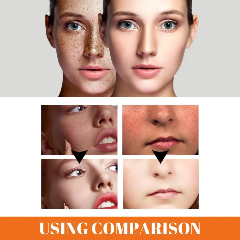 Facial Fade Spots Papaya Cream Anti-aging Brighten Skin Tone Day Cream Moisturiz Skin Improve Dark Spots Fine Lines Night Cream - Image 3